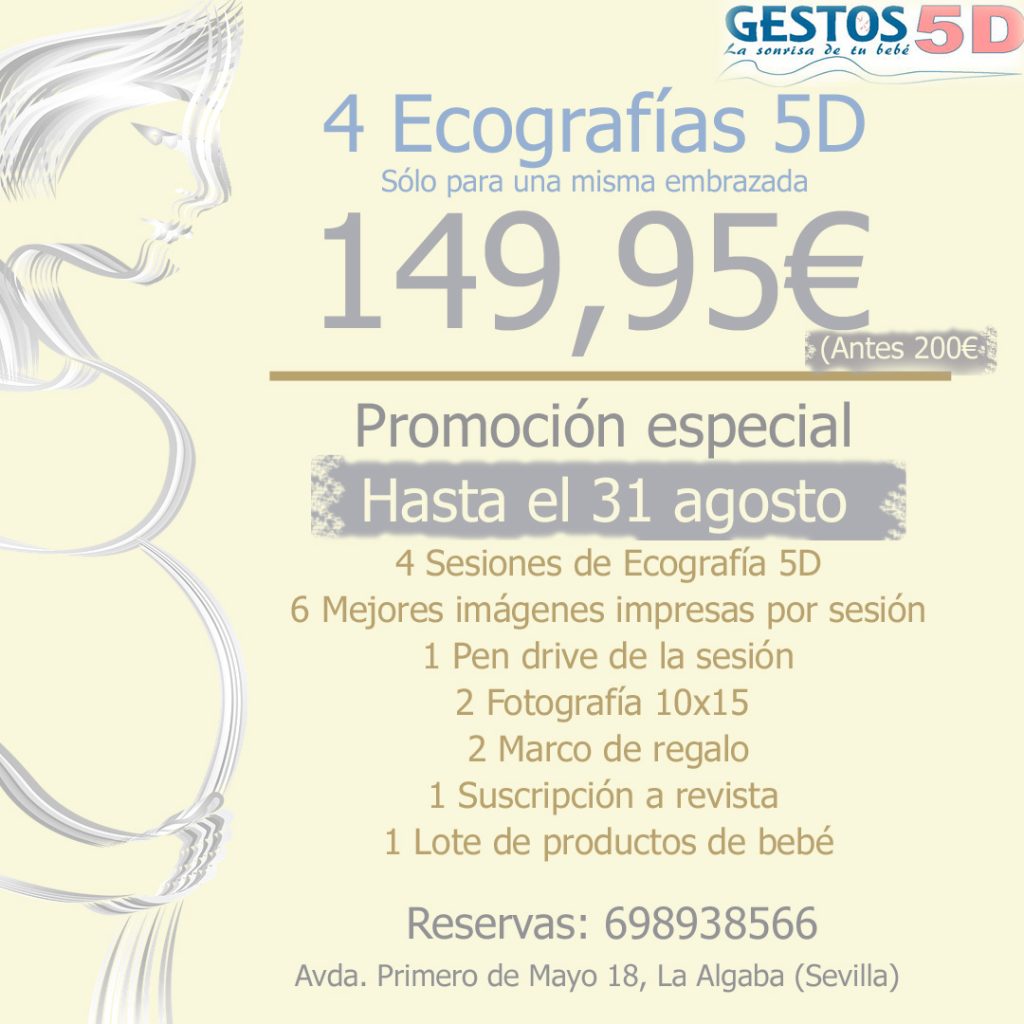 Sigue tu embrazo en Sevilla con eco 5d