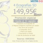 Sigue tu embrazo en Sevilla con eco 5d