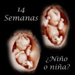 Eco de 14 semanas