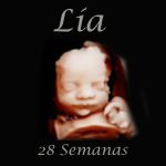 Eco de 28 semanas