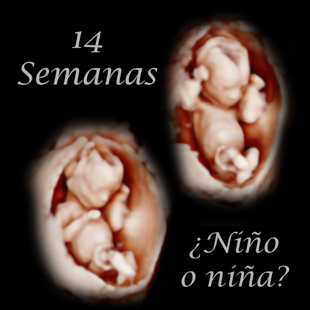 Ecografía 5D de 14 semanas